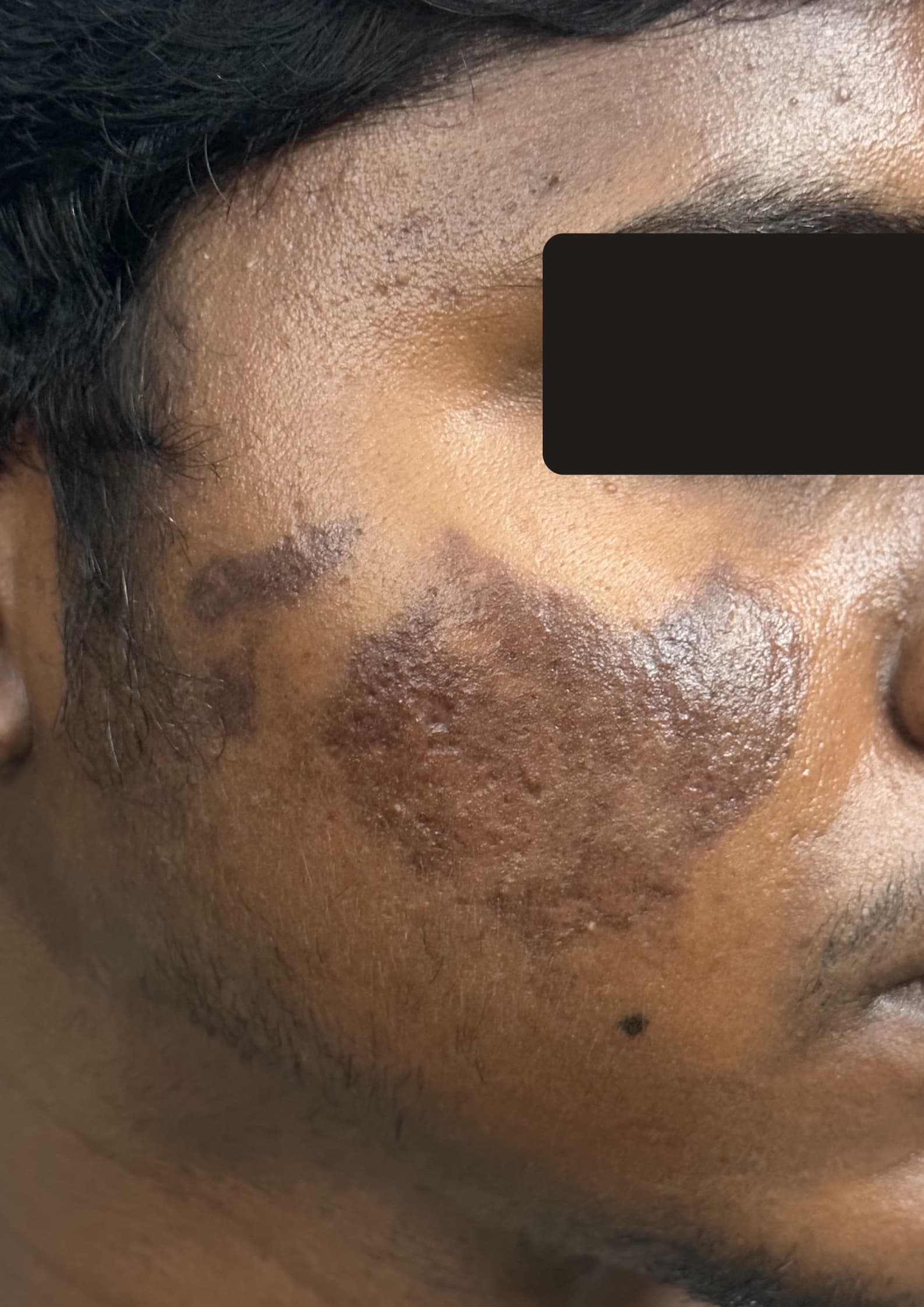 Before treatment