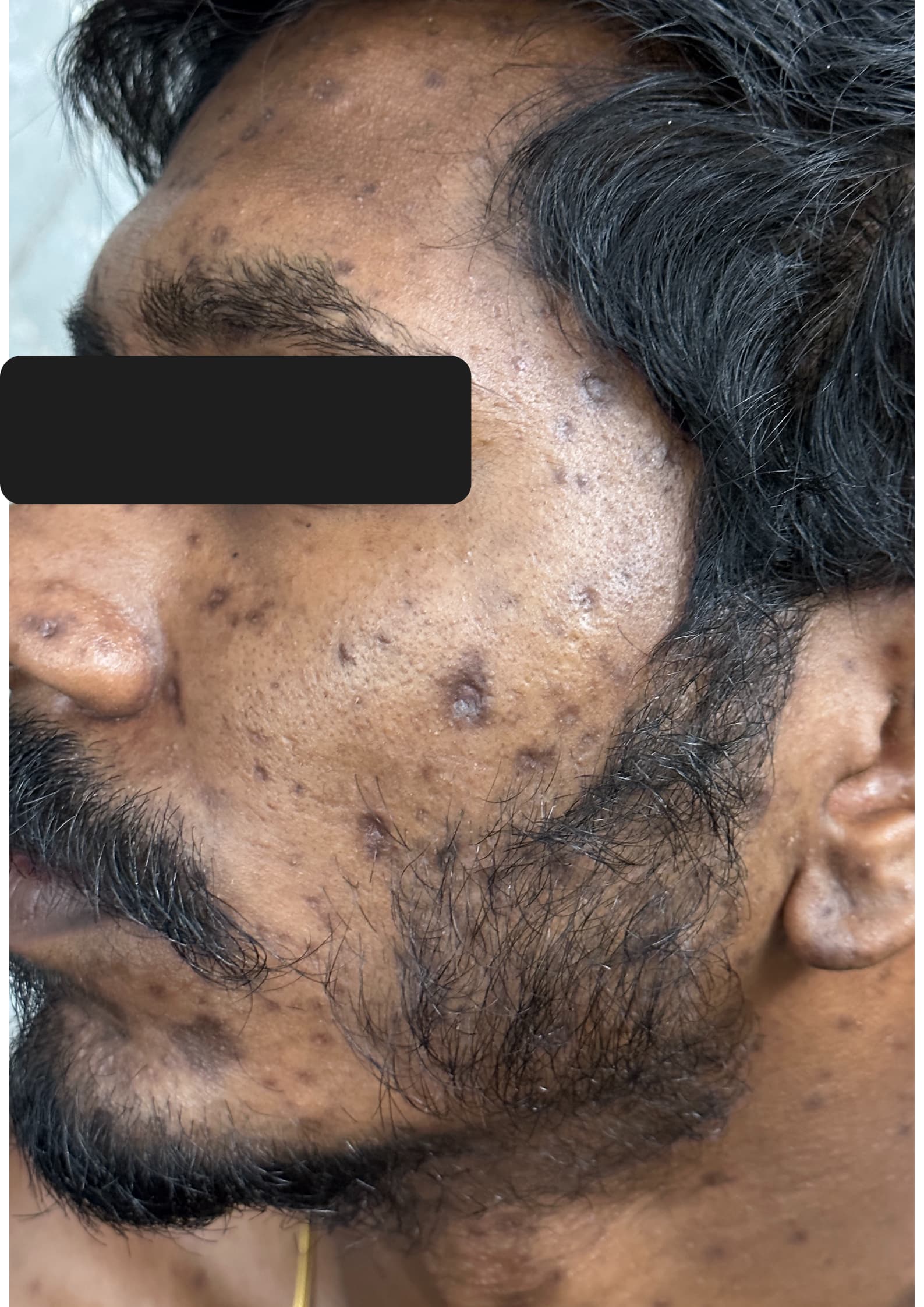Before treatment