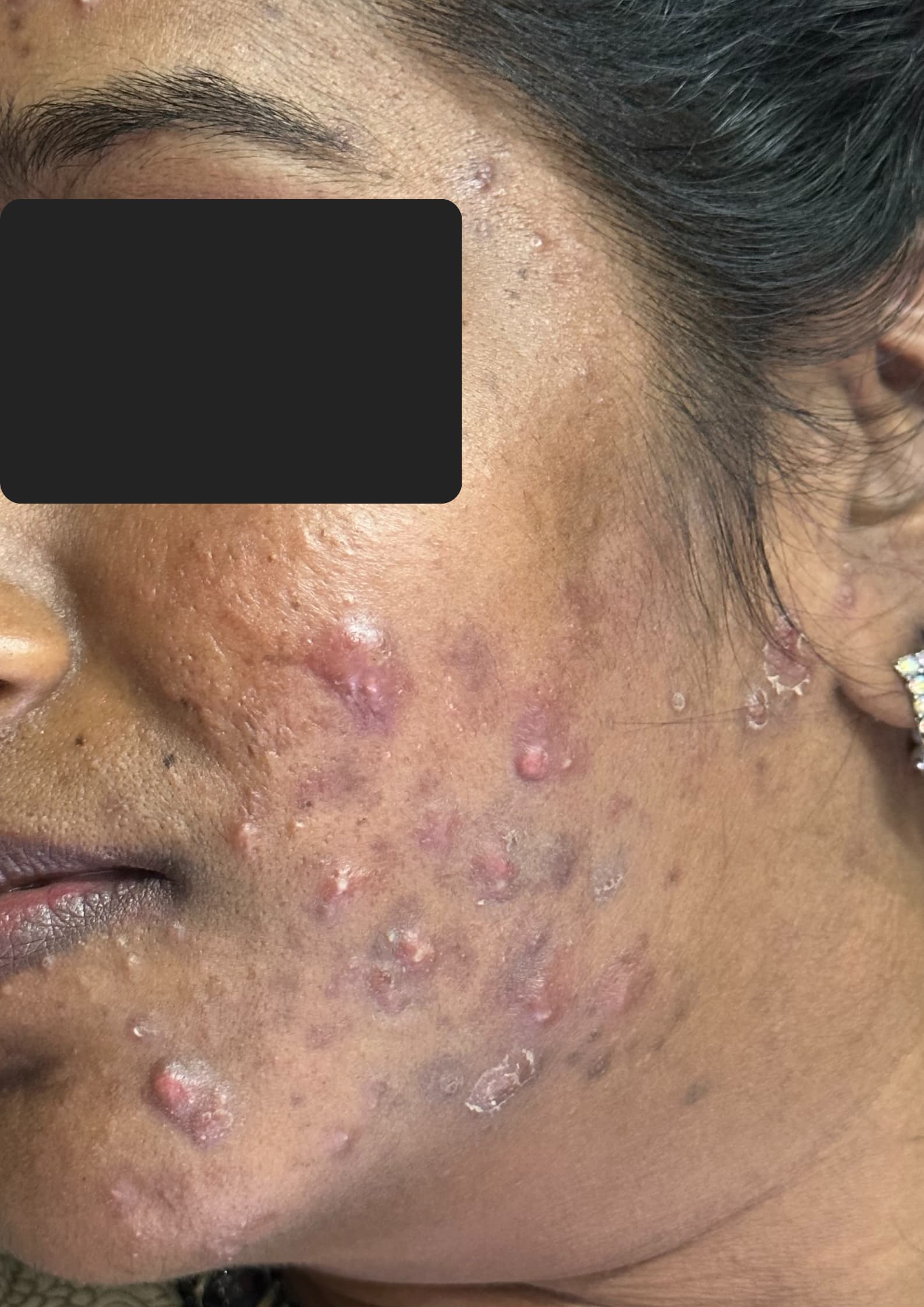Before treatment