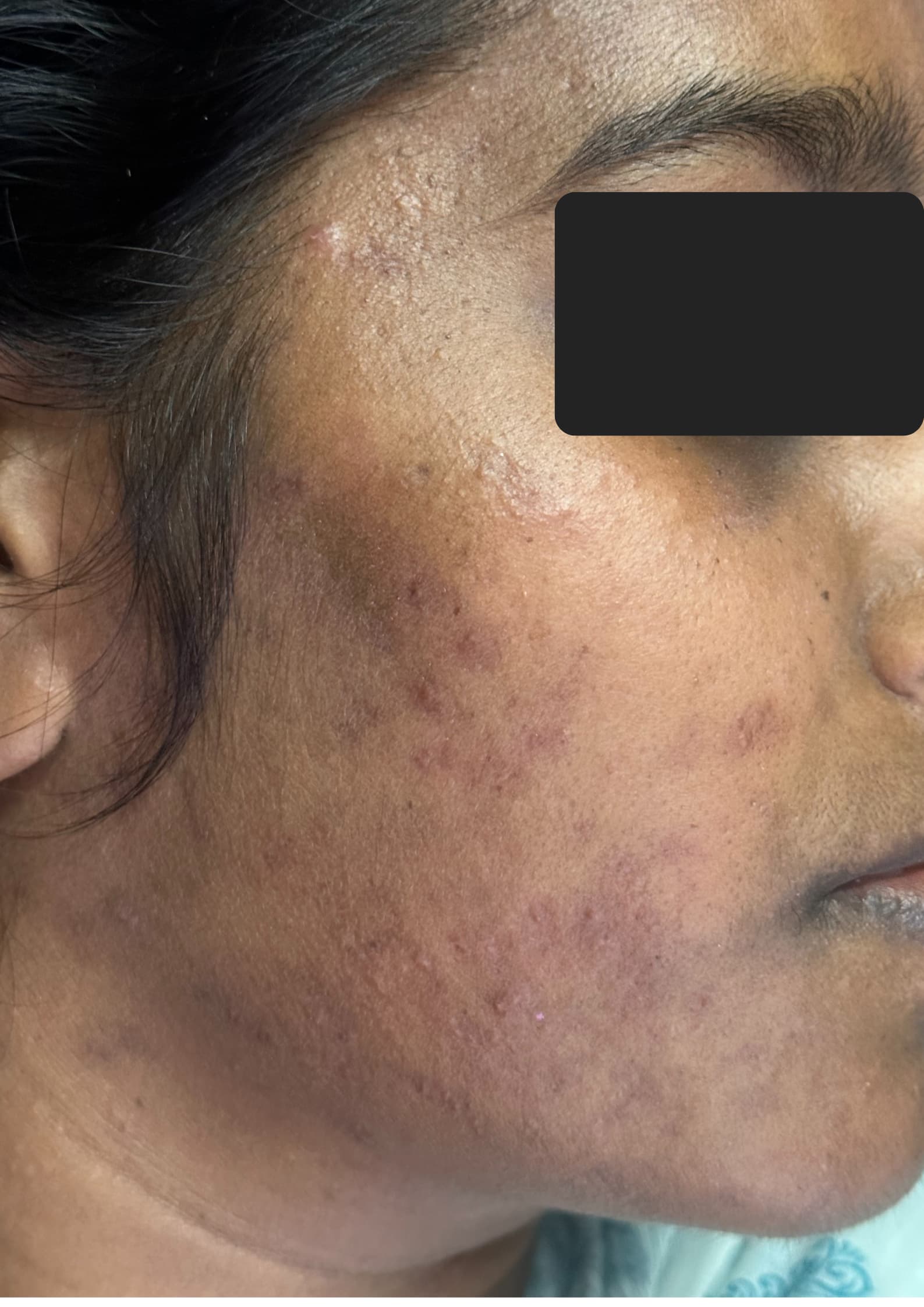 After treatment