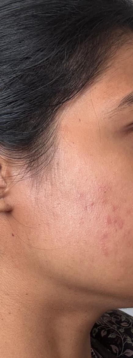 After treatment
