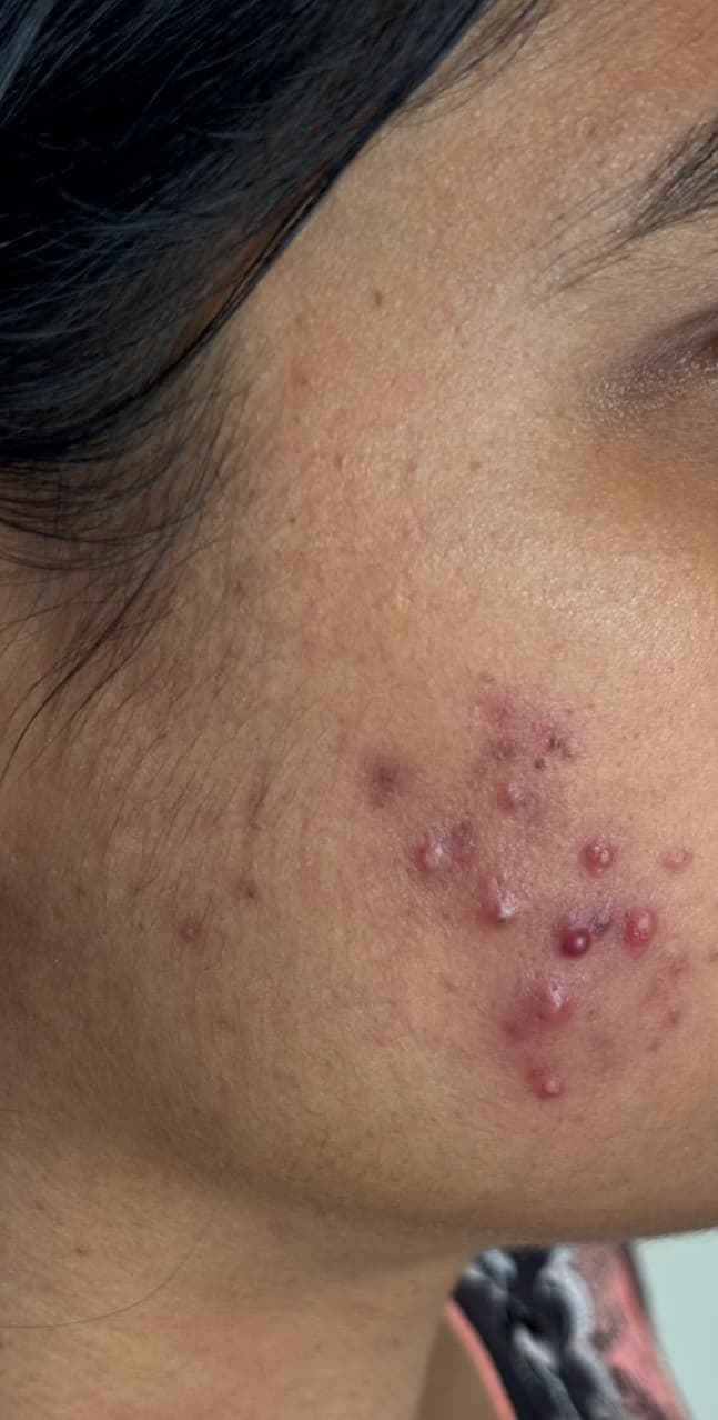 Before treatment